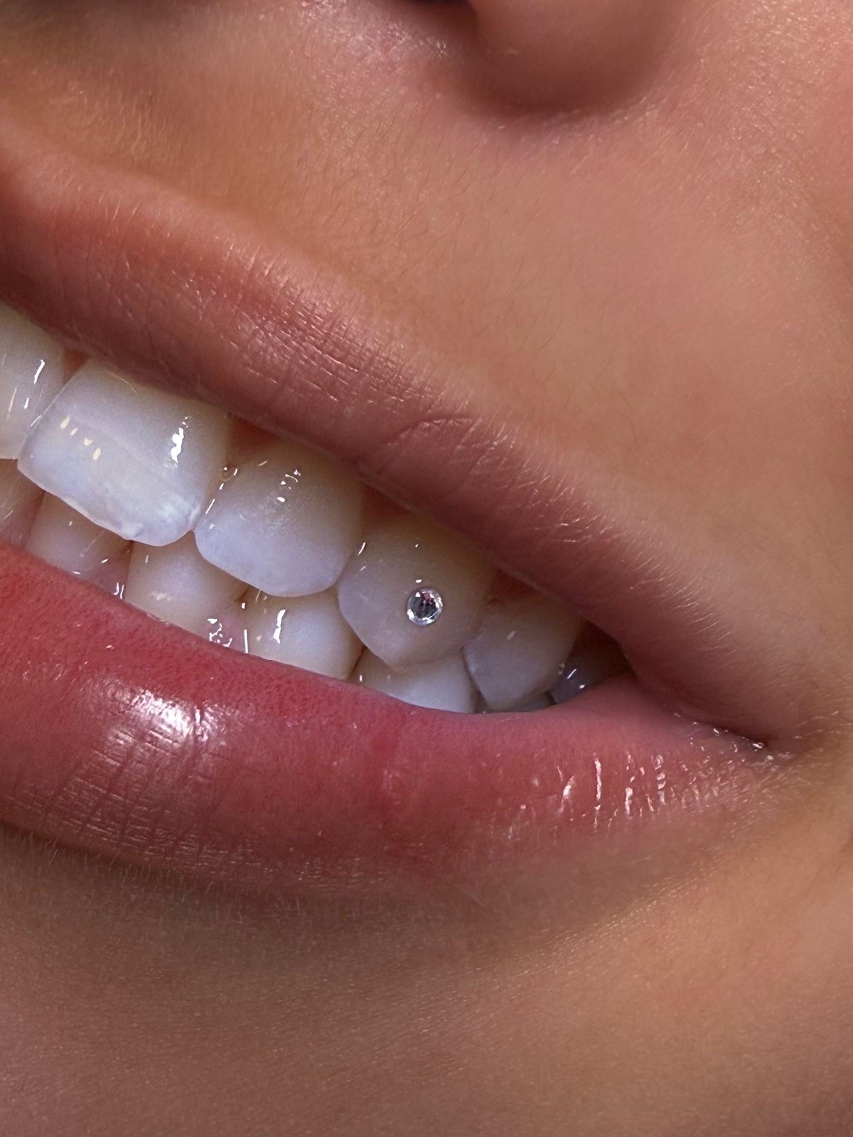 Resultado de piercing dental
